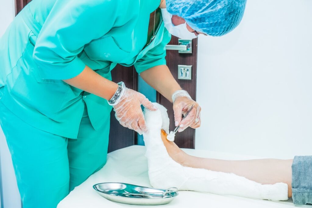 auxílio acidente - enfermeira engessando a perna de uma paciente